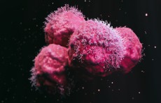 "نتائج سريرية مدهشة" يحققها لقاح جديد لسرطان دماغي فتاك