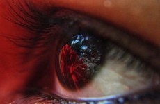 عدد الأوعية الدموية في العين قد يكشف مبكرا عن مرض لا دواء له