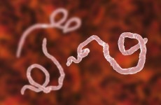 الإيبولا ينتقل إلى بلدة نائية في الكونغو