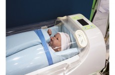 دراسة تكشف مخاطر الولادة القيصرية
