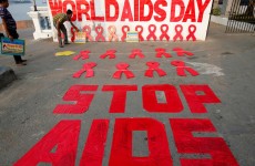 خبير يكشف عن أسباب انتشار "الإيدز" في أوروبا