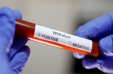 وزارة الصحة تسجل 30 اصابة جديدة بفيروس بكورونا