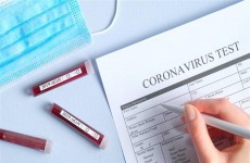 إيطاليا تسجل 619 وفاة جديدة بفيروس كورونا خلال 24 ساعة