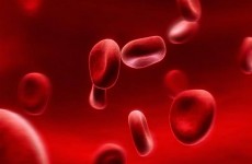 دراسة: عدم فعالية لقاحات كورونا لمصابي سرطان الدم