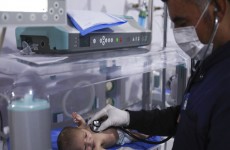 الصحة العالمية تدعو إلى اتخاذ إجراءات عاجلة لمعالجة سوء التغذية في شمال شرق سوريا