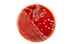العثور على أكبر بكتيريا "لا تشبه أي شيء رأيناه سابقا"!