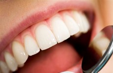 أطباء يحذرون من أضرار معاجين تبييض الأسنان