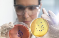 العلماء يكتشفون نشاطا غير متوقع في بكتيريا "ميتة"