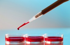 لأول مرة في العالم .. استخدام دم نما في المختبر في عملية نقل الدم إلى البشر