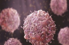 6 أشياء اكتشف الباحثون في عام 2022 أن السرطان مرتبط بها