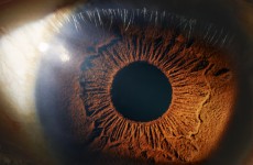 هل وجد العلماء طريقة لعكس فقدان البصر؟
