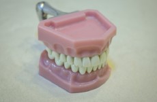 دراسة جديدة تحذر من خطر إهمال أطقم الأسنان وأثره على الرئتين