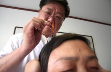 طبيبة مختصة: "الإبر الصينية" لم تثبت فعاليتها علميا