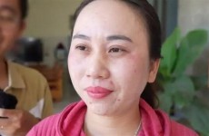 فيتنامية تعاني من الأرق منذ 11 عاما