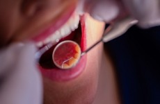 ما هي أعراض سرطان تجويف الفم؟