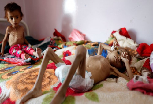 "وجه الحرب القبيح"... رحلة طفلة يمنية تحت "أقبية الجوع"