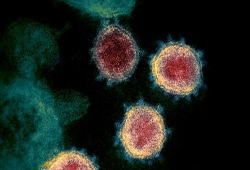العلماء يحددون "خدعة" يستخدمها فيروس كورونا