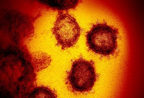 علماء: فيروس كورونا قد يسبب الإصابة بمرض باركنسون