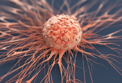 دقائق نانوية متطورة تحرم الخلايا السرطانية من الحماية من العلاج المناعي